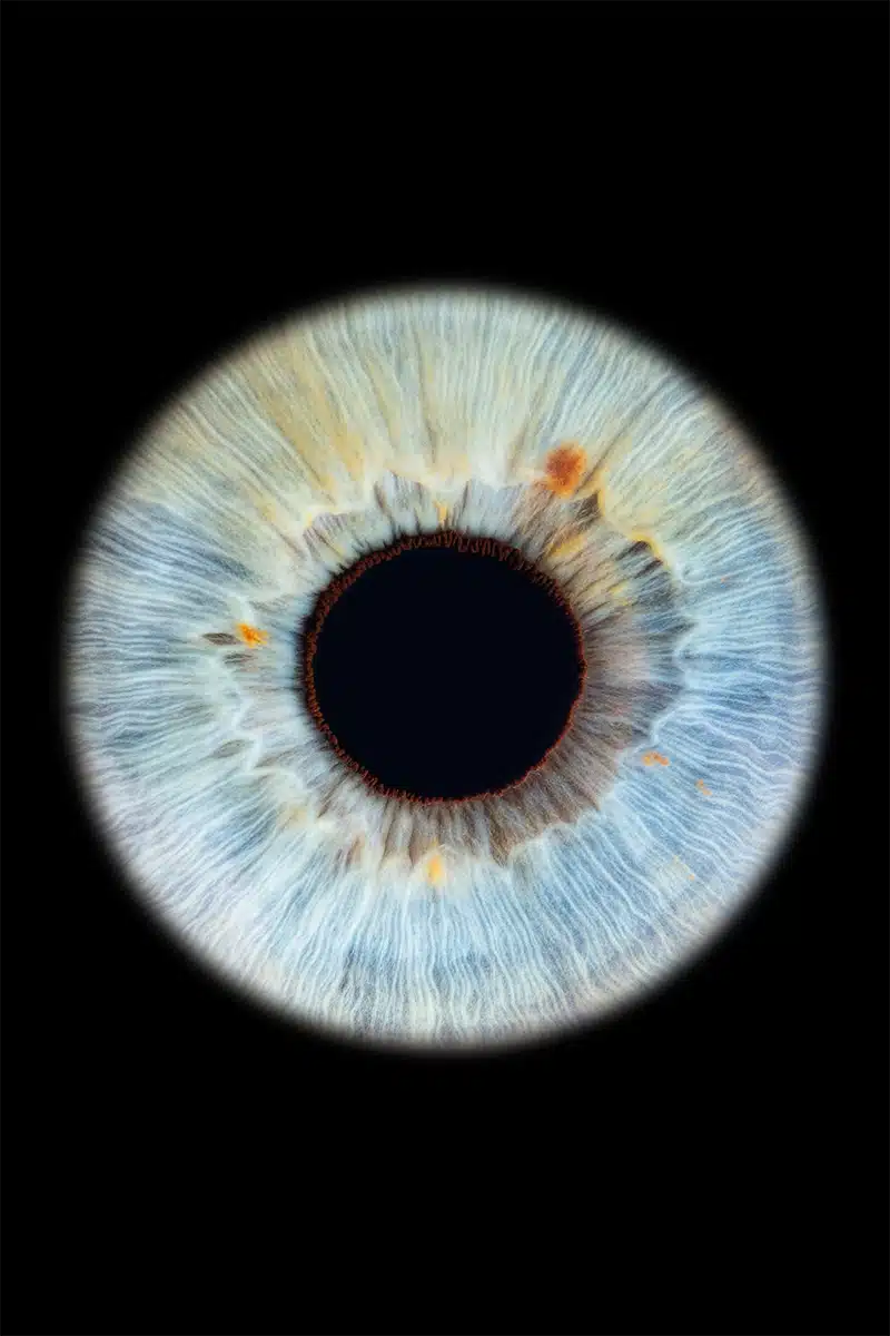 Irisfotografie Einzelportrait – IRISIOpic Siegen