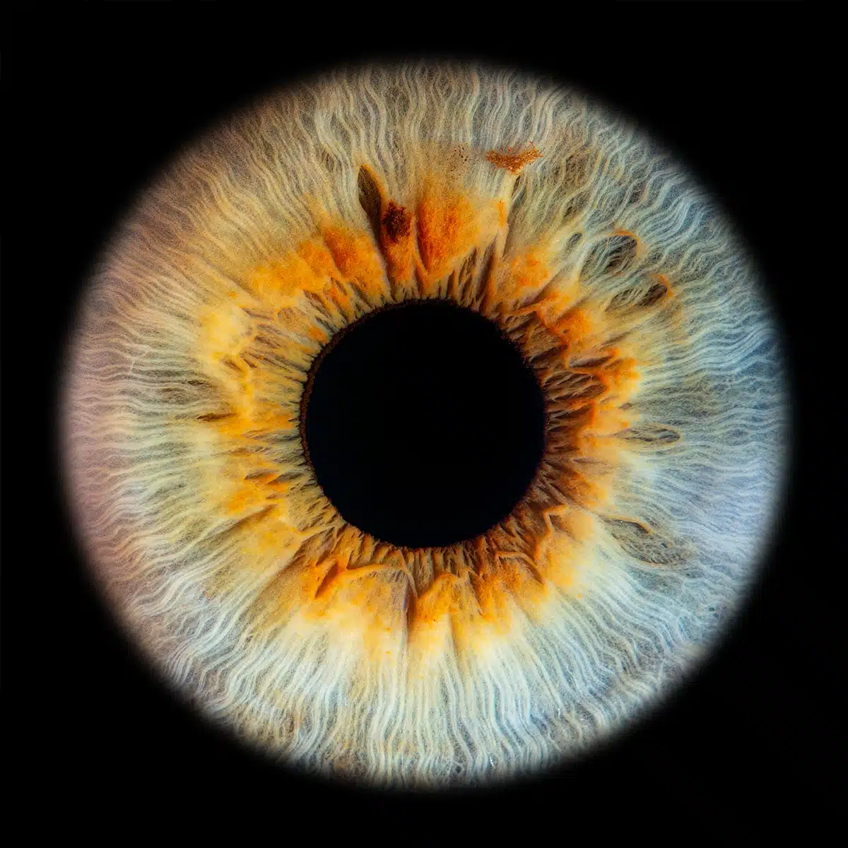 Irisfotografie – IRISIOpic Siegen